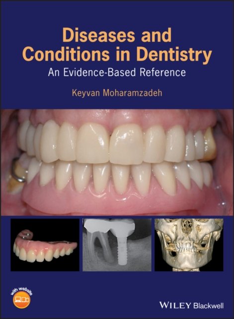 Diseases and Conditions in Dentistry – An Evidence–Based Reference