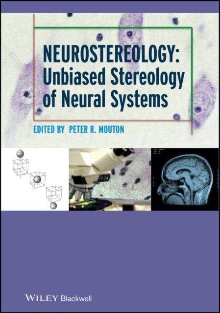 Neurostereology – Unbiased Stereology of Neural Systems