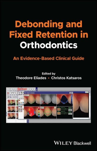 Debonding and Fixed Retention in Orthodontics – An  Evidence–Based Clinical Guide