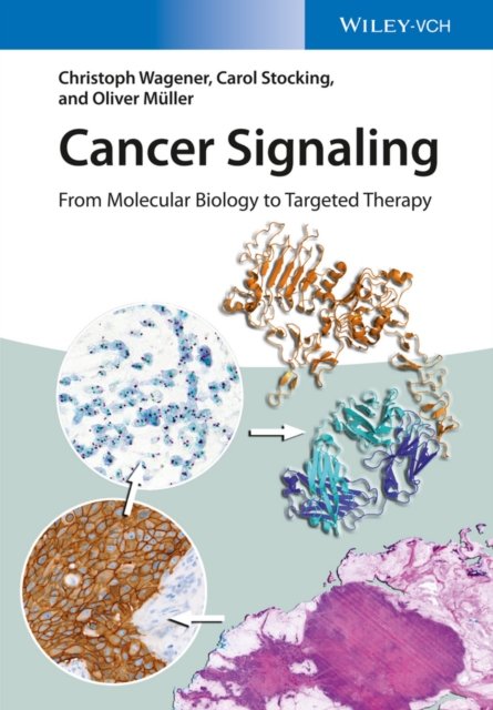 Cancer Signaling – From Molecular Biology to Targeted Therapy