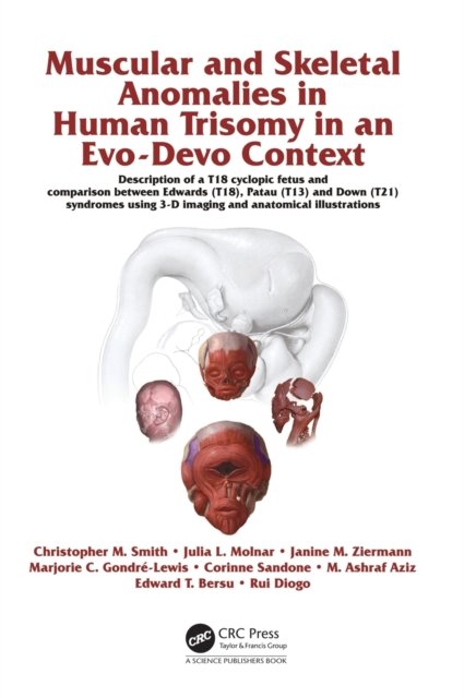 Muscular and Skeletal Anomalies in Human Trisomy in an Evo-Devo Context