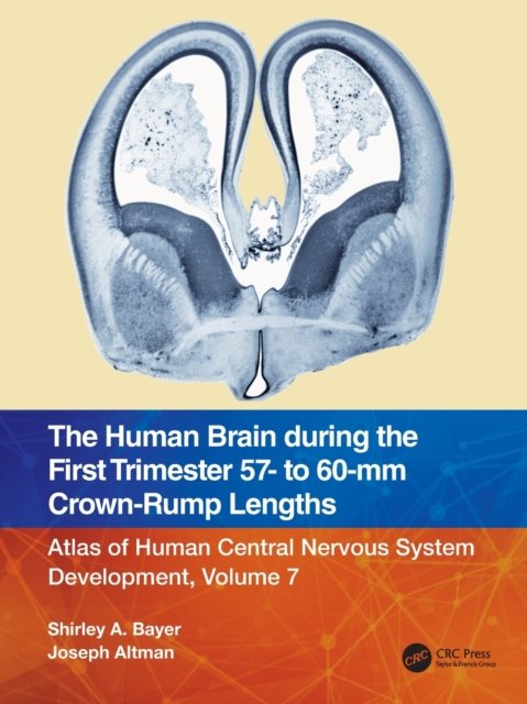 The Human Brain During the First Trimester 57 to 60-mm Crown-rump Lengths