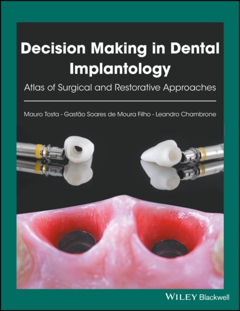 Decision Making in Dental Implantology – Atlas of Surgical and Restorative Approaches