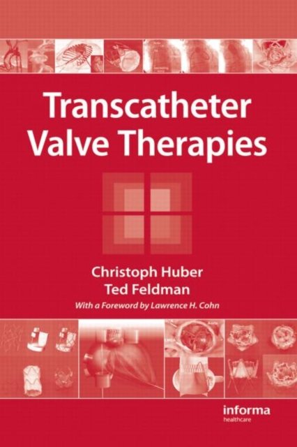 Transcatheter Valve Therapies