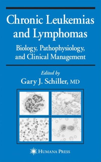 Chronic Leukemias and Lymphomas