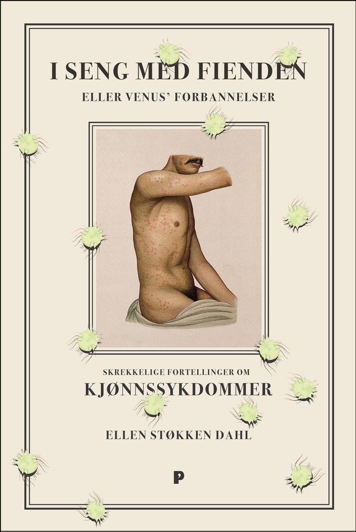 I seng med fienden, eller Venus' forbannelser - skrekkelige fortellinger om kjønnssykdommer