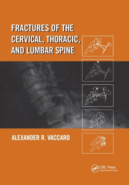 Fractures of the Cervical, Thoracic, and Lumbar Spine