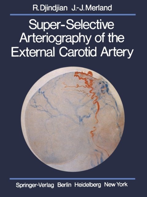 Super-Selective Arteriography of the External Carotid Artery