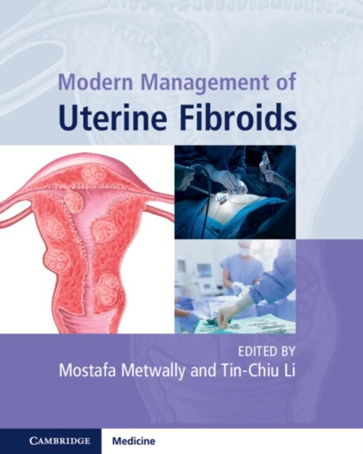 Modern Management of Uterine Fibroids