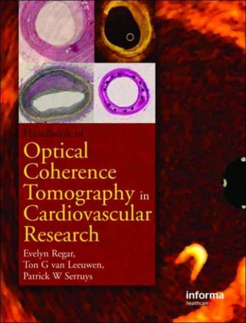 Optical Coherence Tomography in Cardiovascular Research