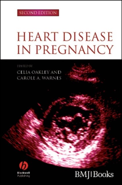 Heart Disease in Pregnancy 2e