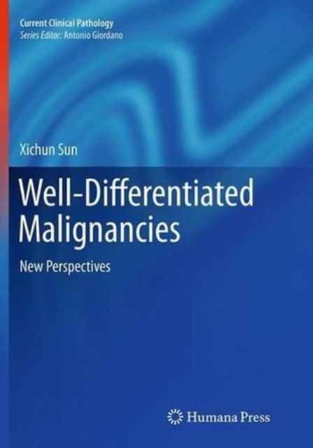 Well-Differentiated Malignancies