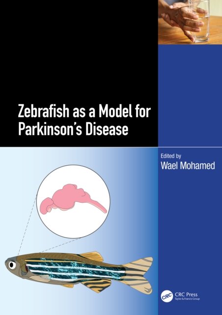 Zebrafish As a Model for Parkinson?s Disease