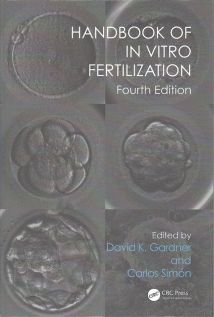 Handbook of In Vitro Fertilization