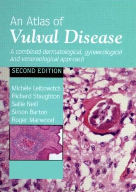 An Atlas of Vulval Diseases