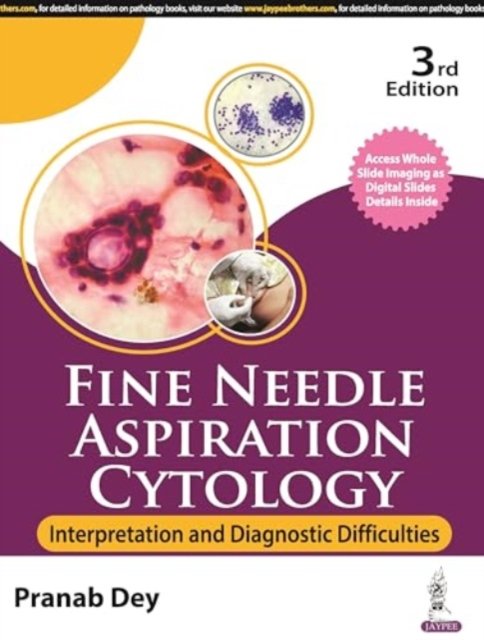 Fine Needle Aspiration Cytology