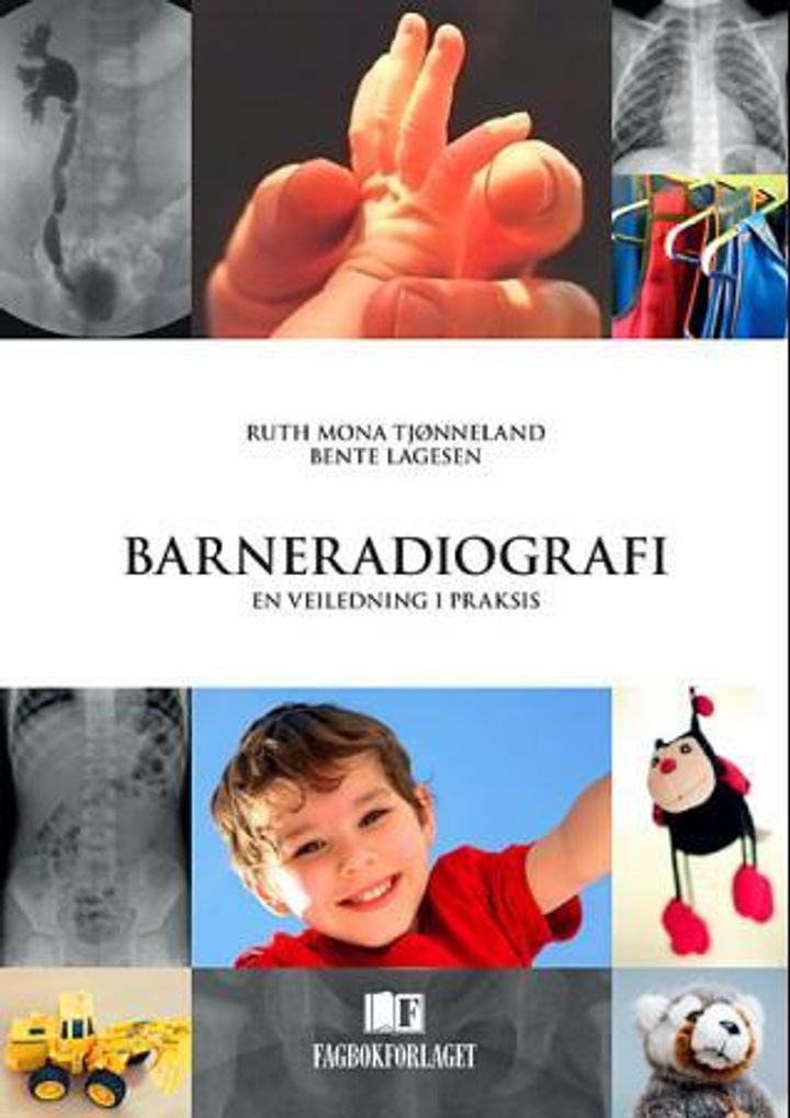 Barneradiografi - en veiledning i praksis