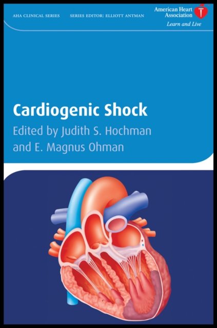 Cardiogenic Shock