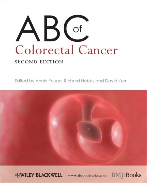ABC of Colorectal Cancer 2e