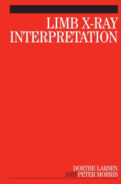 Limb X–Ray Interpretation