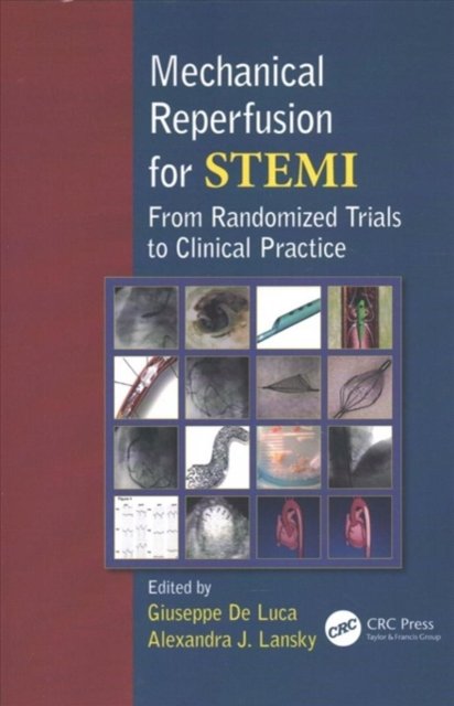Mechanical Reperfusion for STEMI