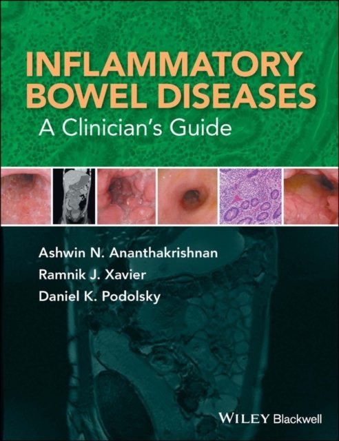 Inflammatory Bowel Diseases – A Clinician's Guide