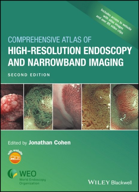 Comprehensive Atlas of High–Resolution Endoscopy and Narrowband Imaging