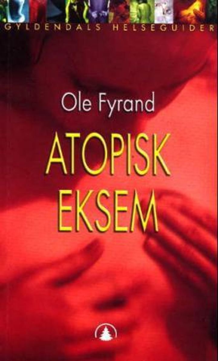 Atopisk eksem - årsaker, forløp og behandling