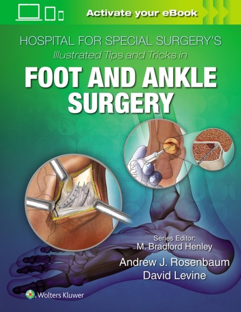 Hospital for Special Surgery''s Illustrated Tips and Tricks in Foot and Ankle Surgery