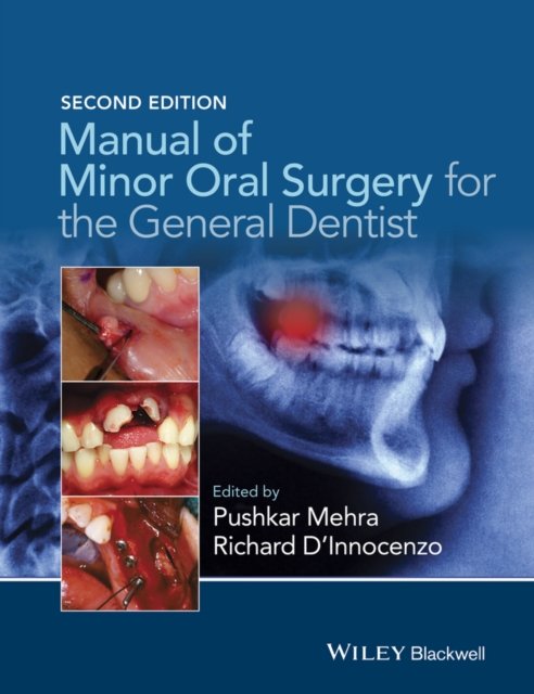 Manual of Minor Oral Surgery for the General Dentist 2e