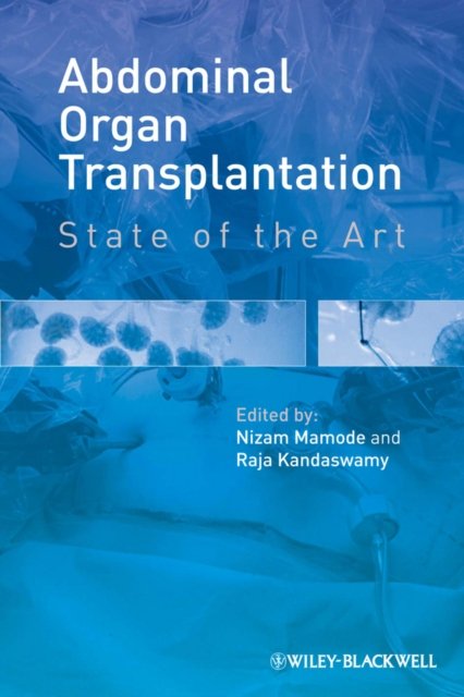 Abdominal Organ Transplantation – State of the Art