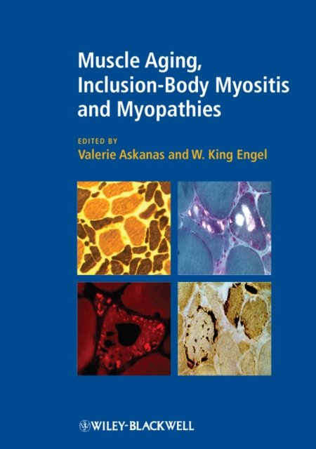 Muscle Aging, Inclusion–Body Myositis and Myopathies