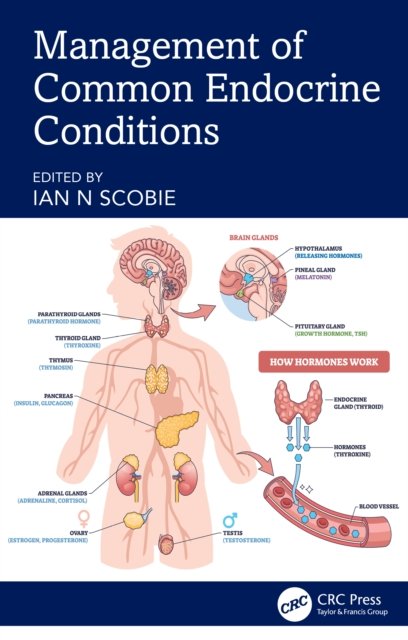 Management of Common Endocrine Conditions