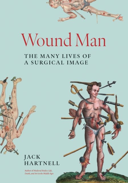 Wound Man
