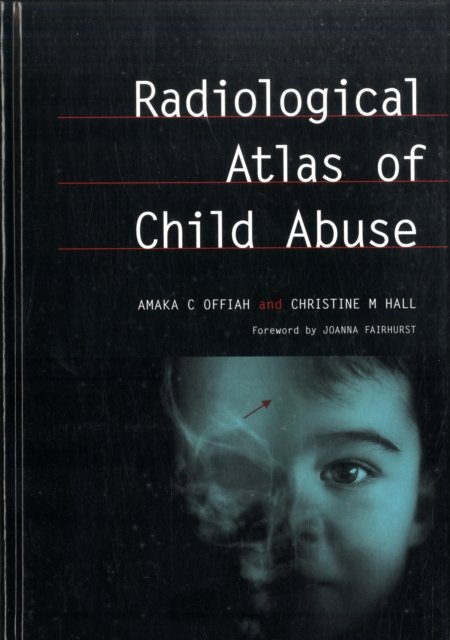 Radiological Atlas of Child Abuse