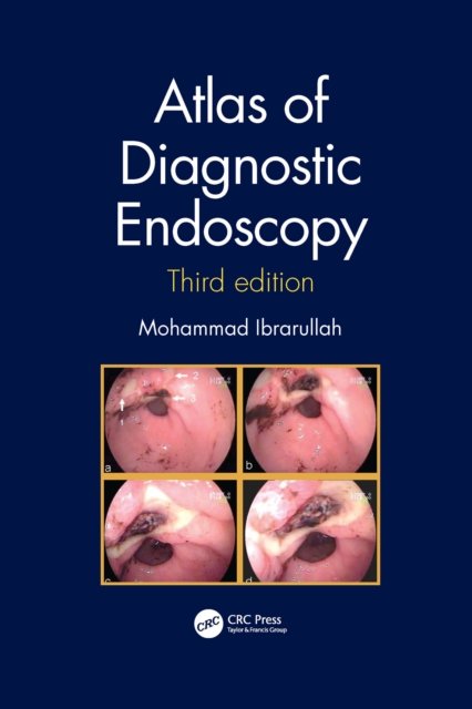 Atlas of Diagnostic Endoscopy