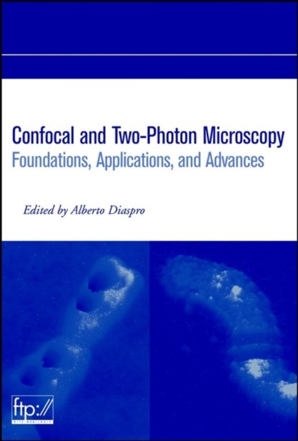 Confocal and Two–Photon Microscopy – Foundations, Applications and Advances