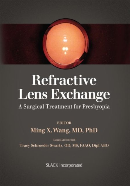 Refractive Lens Exchange