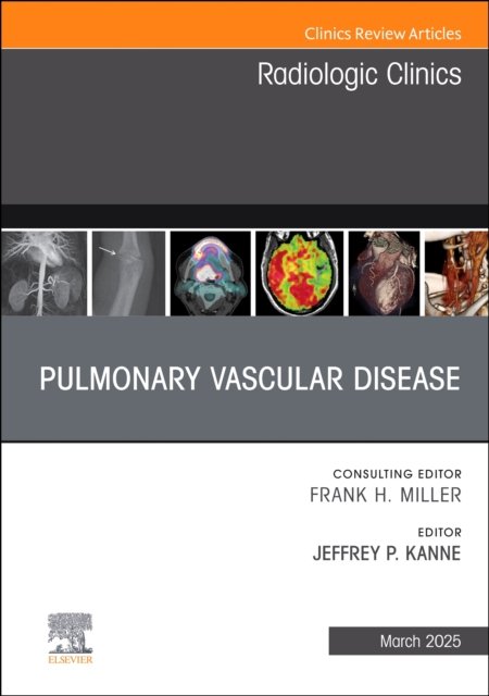 Pulmonary Vascular Disease, An Issue of Radiologic Clinics of North America