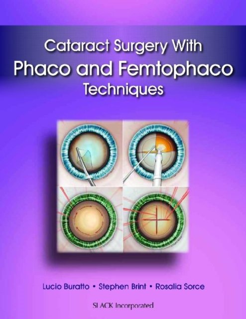 Cataract Surgery With Phaco and Femtophaco Techniques