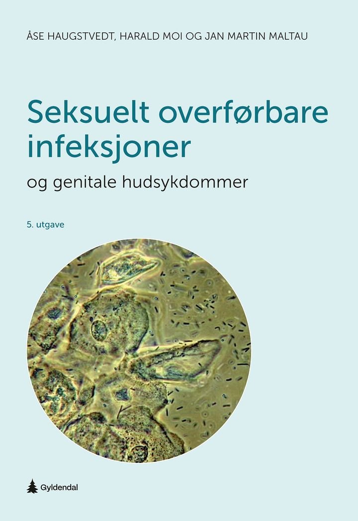 Seksuelt overførbare infeksjoner og genitale hudsykdommer