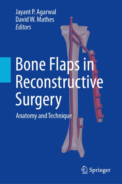 Bone Flaps in Reconstructive Surgery