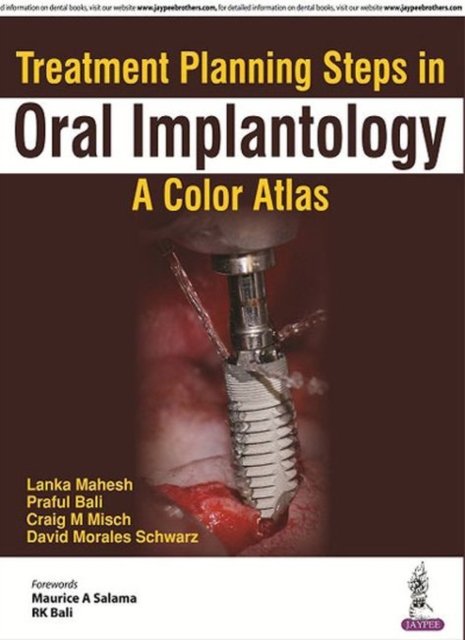 Treatment Planning Steps in Oral Implantology