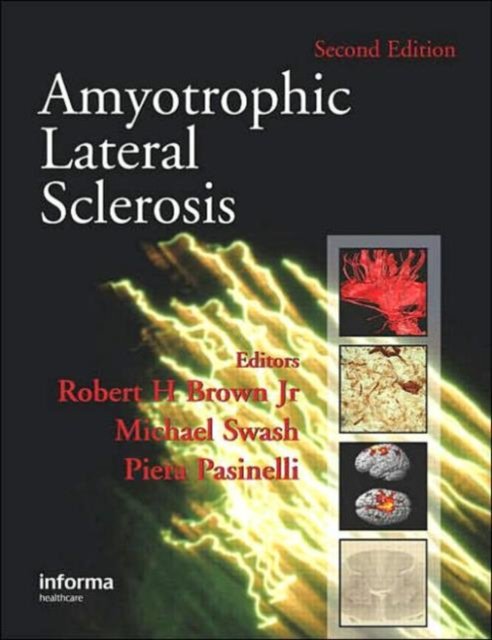 Amyotrophic Lateral Sclerosis, Second Edition