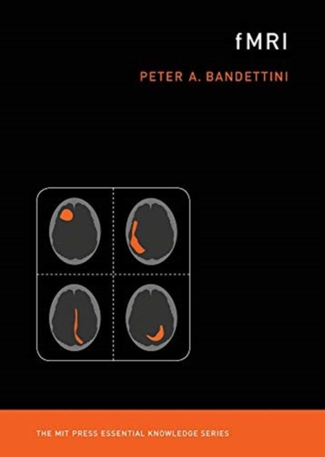 fMRI