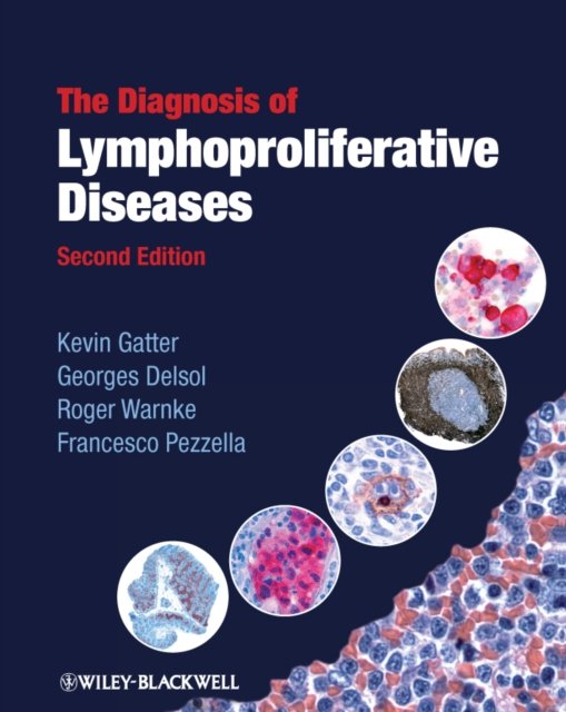 The Diagnosis of Lymphoproliferative Diseases 2e