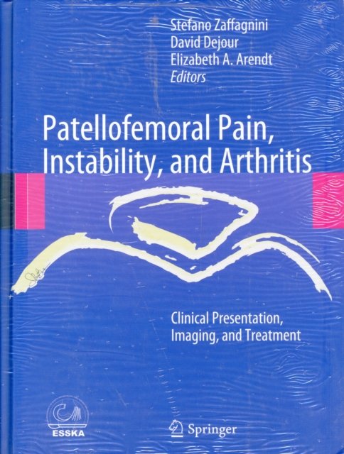Patellofemoral Pain, Instability, and Arthritis