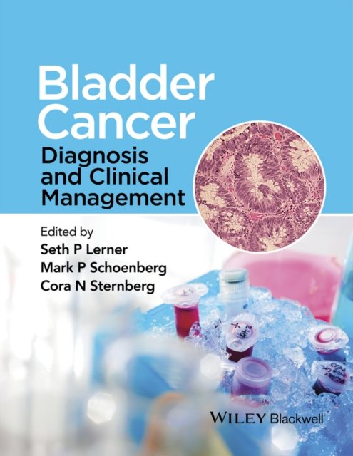 Bladder Cancer – Diagnosis and Clinical Management
