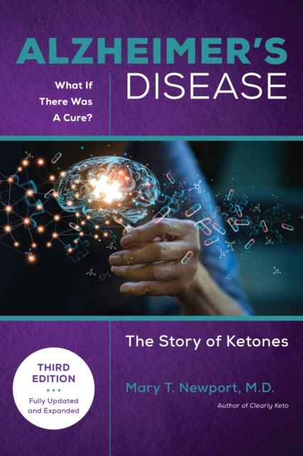 Alzheimer''s Disease