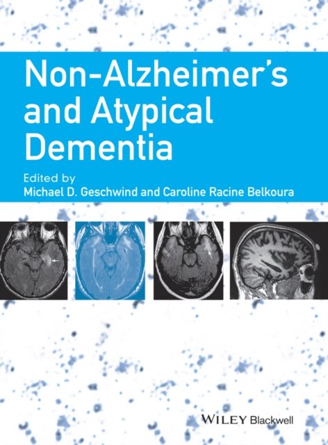 Non–Alzheimer's and Atypical Dementia